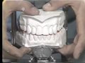 Lec 34 - Mounting the Maxillary Cast on the Articulator