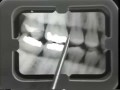 Lec 2 - Radiograph and Digital Examination of the Teeth