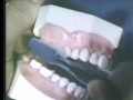 Lec 1 - Oral Hygiene Methods - Toothbrushing and Flossing