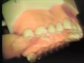 Advanced Dental Implant Surgery