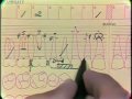 Lec 17  - Periodontal Charting Procedure