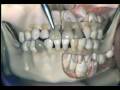 Lec 1 -Dental Anatomy: Primary Dentition