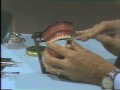 Lec 13-Dental Anatomy: Waxing a Maxillary Central Incisor