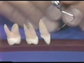 Lec Last - Dental Anatomy and Periodontics