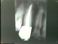 Lec 17- Dental Anatomy and Endodontics