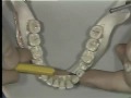 Lec 24-Dental Anatomy: Mandibular Premolars