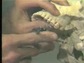 Lec 28 -Oral/Maxillofacial Surgery and Dental Anatomy