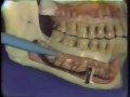 Lec 29 -Dental Anatomy: Mandibular Molars
