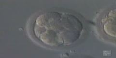 Blastocyst Formation