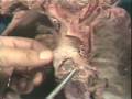 Lec 4 -Dissection: Thoracic Contents
