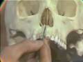 Lec 6 Dissection: Human Skull - Part II