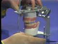 Lec 100 - Delivery of Complete Denture - Part 2