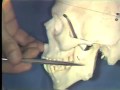 Lec 31 -Gross Anatomy: Nerve Supply to Teeth; Maxillary Sinus