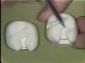 Lec 23 - Dental Anatomy and Restorative Dentistry