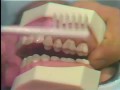 Lec 1 - Survey of Oral Hygiene Devices