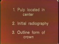 Lec 21 - Endodontic Cavity Preparation