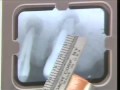Lec Last - Pre-Clinical Endodontics - multi-rooted tooth