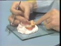 Lec 138  - Repairing a Broken Denture