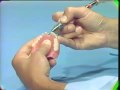 Lec 139  - Replacing a Broken Complete Denture Tooth