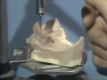 Lec 150 - Bonding Technology for a Removable Partial Denture