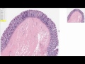 Lec 9 - Normal Colon Tissue