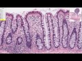 Signal transmission from nerve to tissue