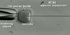 IVF & ICSI Process