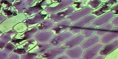 Onion Cells Plasmolysis