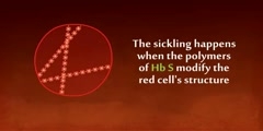 What is sickle cell disease ?