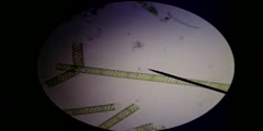 Spirogyra