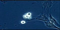 Microscopic View For Death of Cells