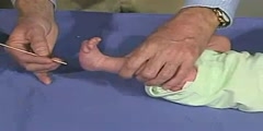 Infant Clinical Examination