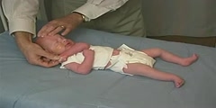 Examination for Tone And Scarf Sign of a Newborn