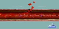 The Process of Blood Clotting