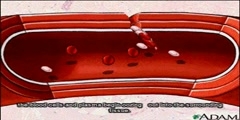 How does the blood clotting process work?