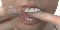 Floss Your Teeth Properly