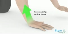 How is a wrist fracture is treated? by Bupa