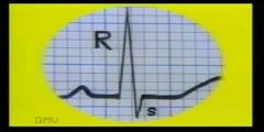 Introduction With ECG Reading