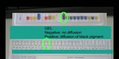 Using API strips - microbiology lesson 3