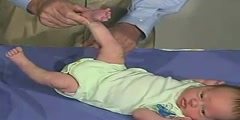 Newborn Clinical Examination - Tone Leg Traction