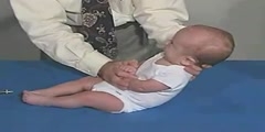 Primitive reflexes and moro reflex clinical examination for a three months infant