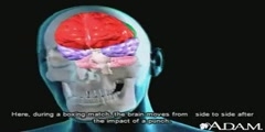 What happens in a head injury?