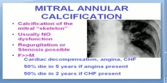 Heart Disease - Medical School Pathology