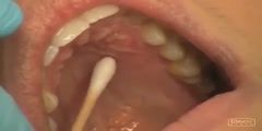 Blockage of Anterior Middle Superior Alveolar Nerve