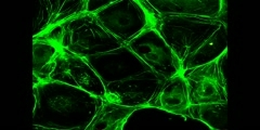 What is Fluorescent Confocal Microscopy?