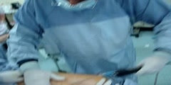 Live Liposuction surgery by Dr Kamal