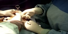 Breast augmentation, mammoplasty and breast surgery