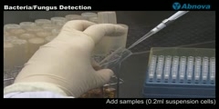 Detection of bacteria and fungus in tissue culture