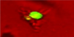 Activated T Cell Under Microscope
