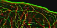 Microtubule and ER Dynamics